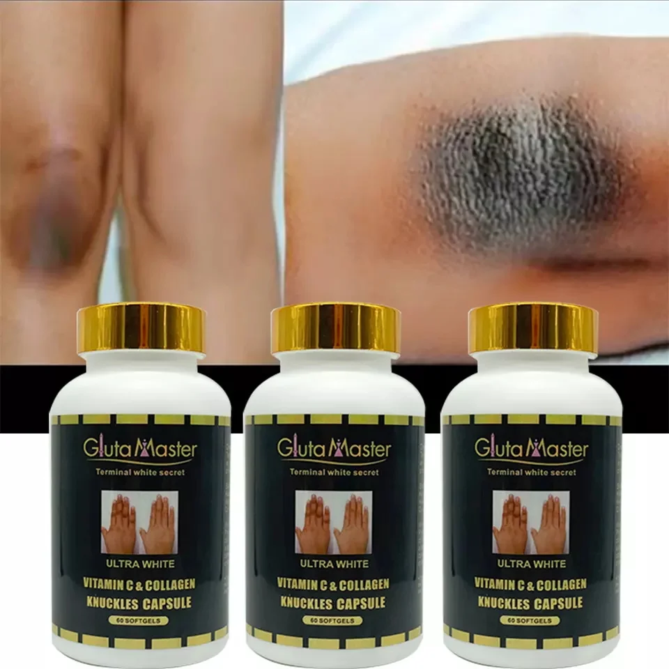 Private Label Collagen Capsules Supplement Hand Dark Knuckle Knees Elbows Remover Bleaching Tablets Fast Skin Whitening Pills
