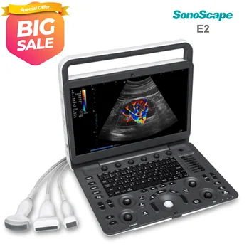 Manufacturer Cheap Price Potable 4D Color Doppler Ultrasound Machine for Hospital