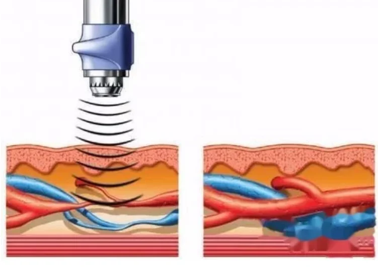 manufacture 2021 new shockwave therapy machine for your health