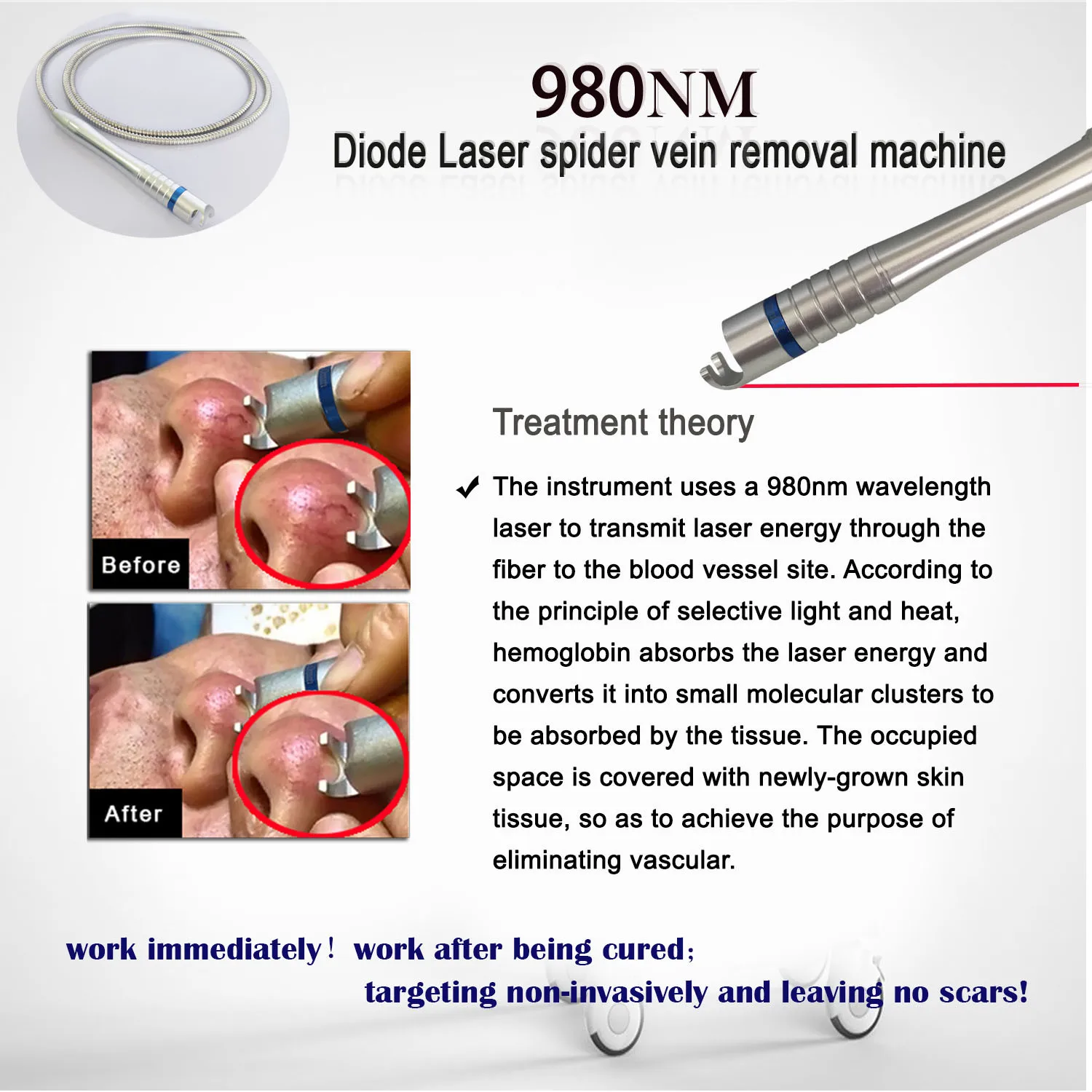 new portable 980nm 5 in1 30w 40w 100mw high-power cw fiber coupled ir pump laser diode vascular spider varicose veins removal