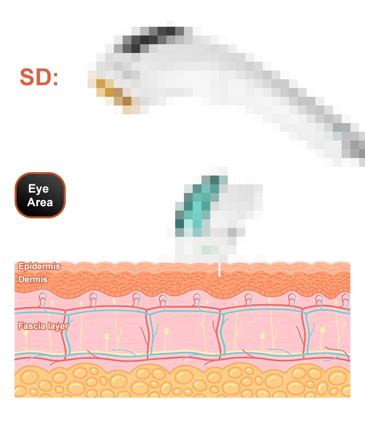 Máquina de belleza portátil Hi Fu 12D para rostro y cuerpo, ultrasonido focalizado de alta intensidad, máquina de ultrasonido 12D, máquina de lifting Smas