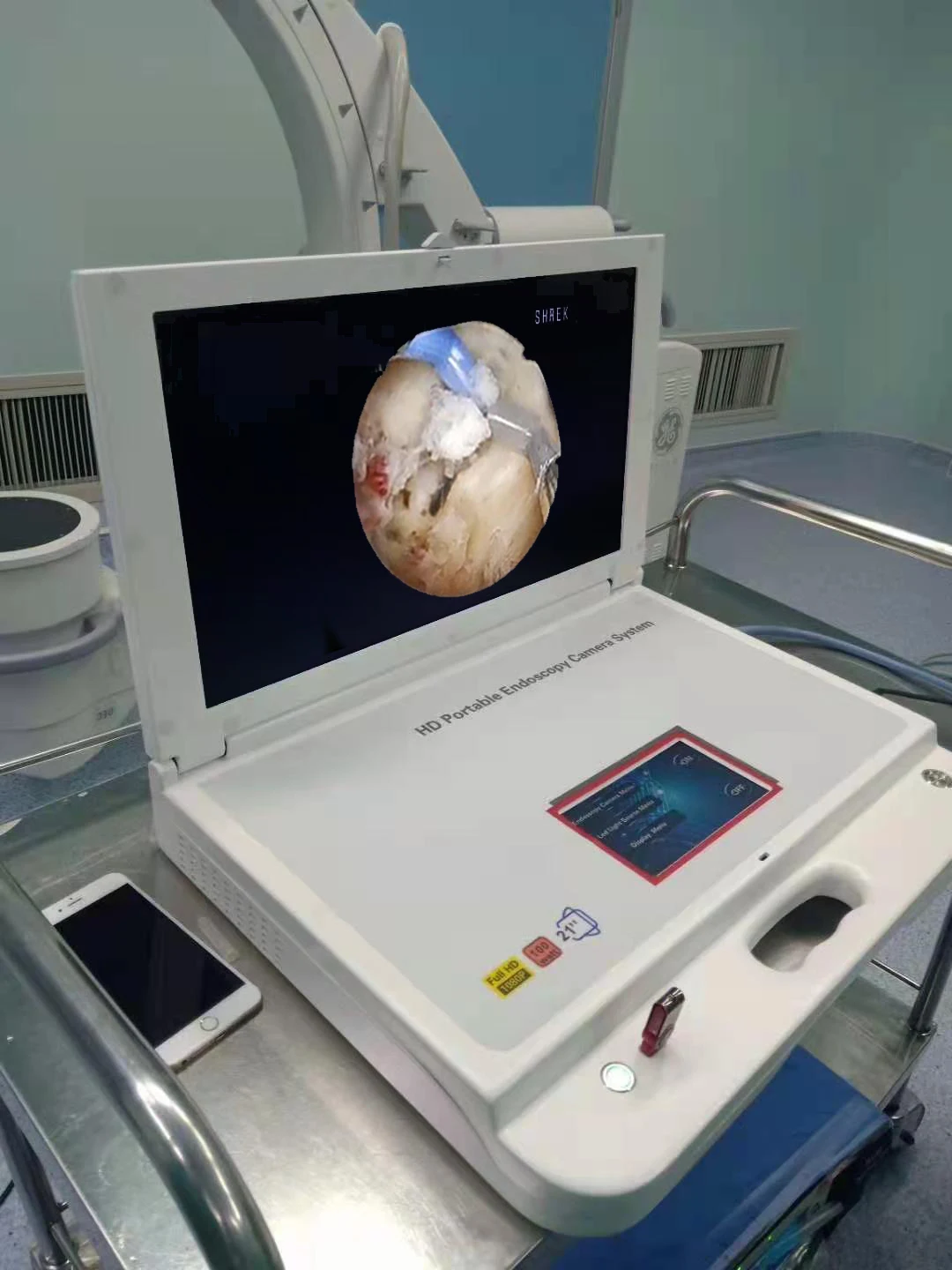 Portable Ent Endoscope Camera with Sinuscope Rigid Endoscope for Endoscopic Sinus Surgery