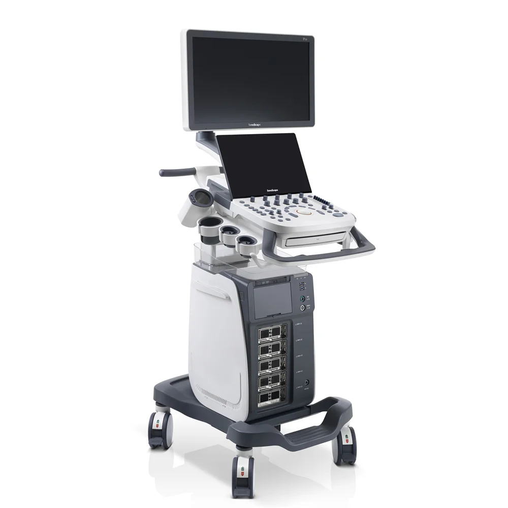 Sonoscape P20 Mobile 3D/4D Real-time Color Panoramic Doppler Trolley Ultrasound Machine