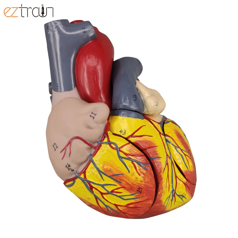 Tse Model Beige Two Lumps In One Testicle Pathological Testicular Model