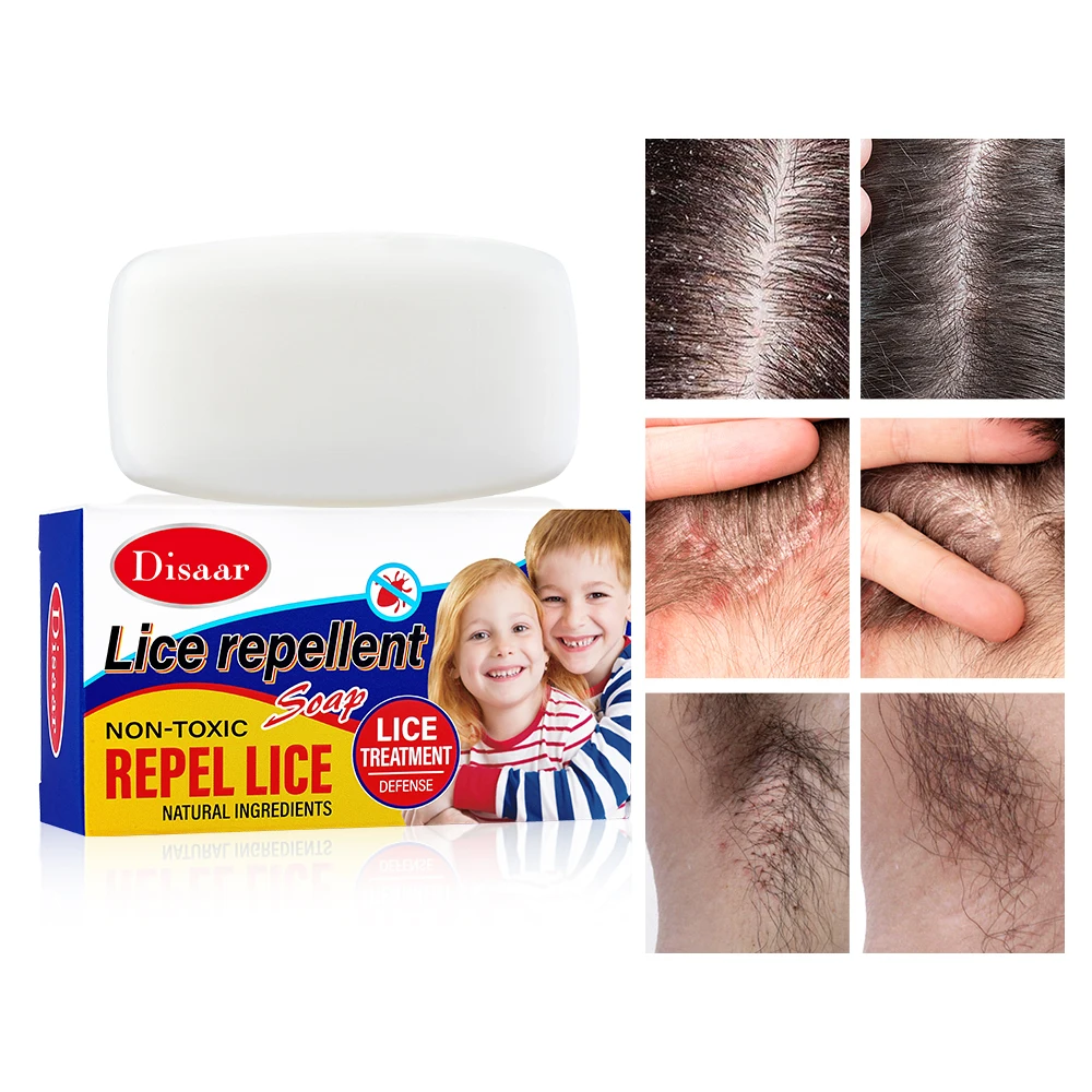 Peppermint & Lemon Extract Refreshing Oil Control Repel Lice Relieve Itching Lice Repellent Soap for Lice Remover Treatment