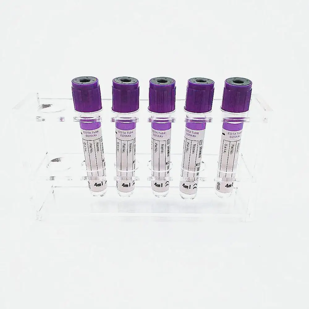 Ohyon Vacuum Blood Collection Tubes Edta K2 Buy Blood Tube For Medical Consumables Medical Blood Vessel Collecting Blood Tubes Product On Alibaba Com