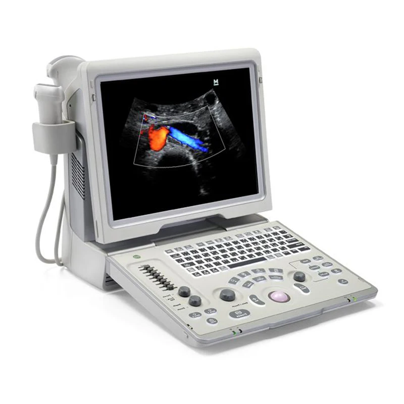 Mindray-Z6 (2).jpg