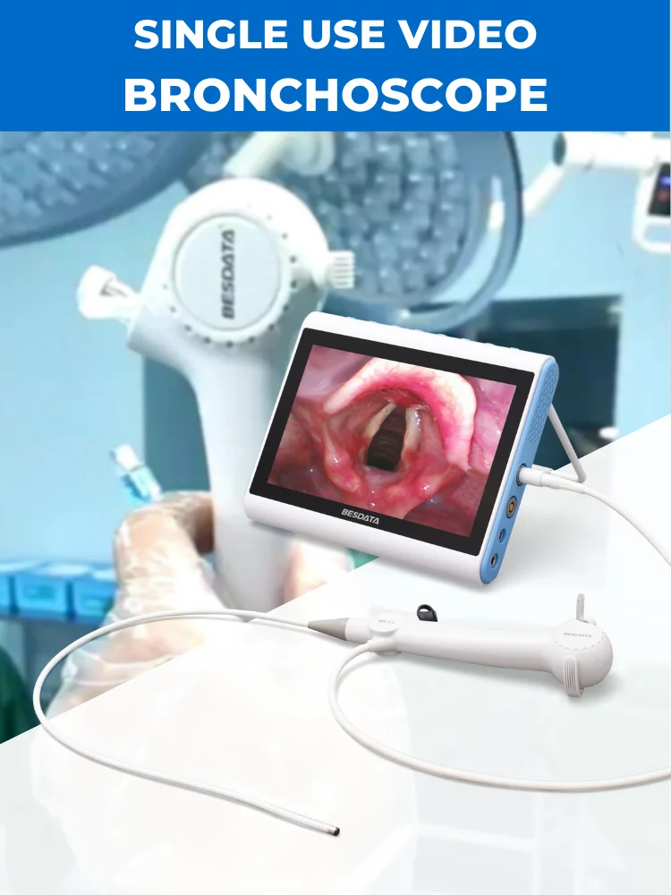 Bronchoscopy Ent Endoscope System ENT Endoscopy Flexible Laryngoscope  Bronchoscopy Cystoscopy Nasopharyngoscope for Surgical