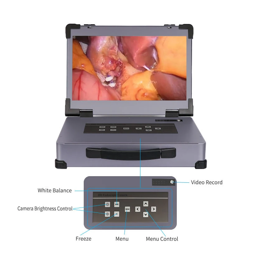 Advanced Laparoscopic Trainer Box With Hd 1080p Endoscope Camera Endoscopic Hd Camera Ent Endoscope Camera factory