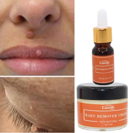 
Крем для лечения бородавок на теле, средство для удаления бородавок на ногах, мазь для ухода за ногами 