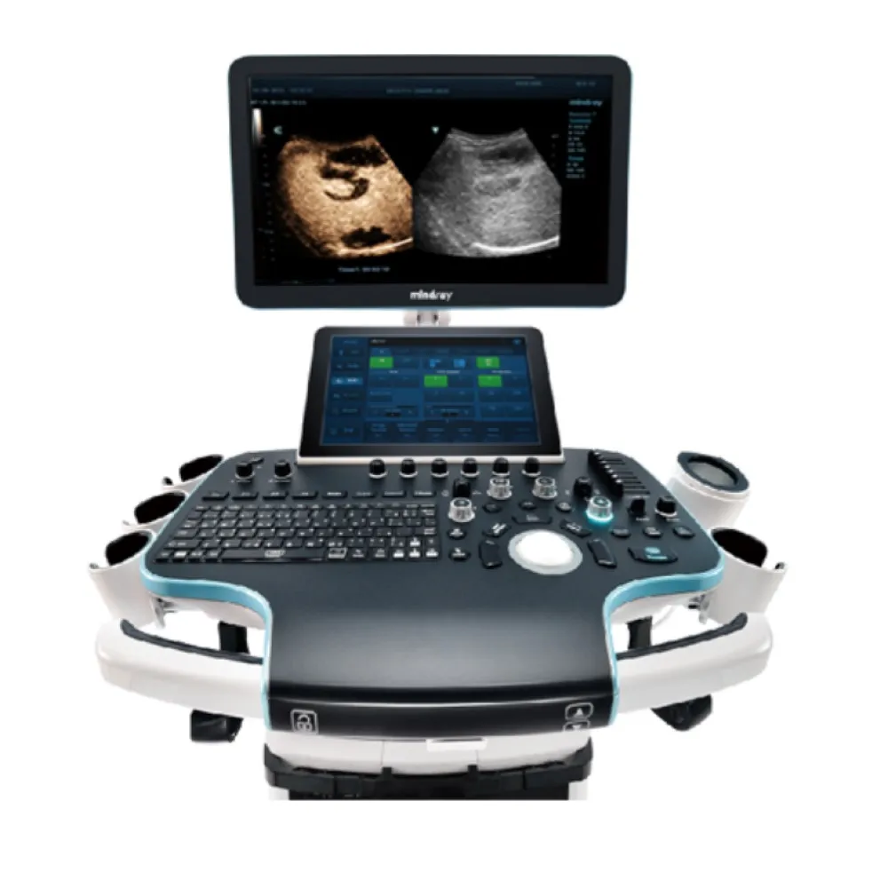 China Best-quality Color Trolley Ultrasound Machine Resona I9 R9 7 Diagnostic Ultrasound System for Clinic