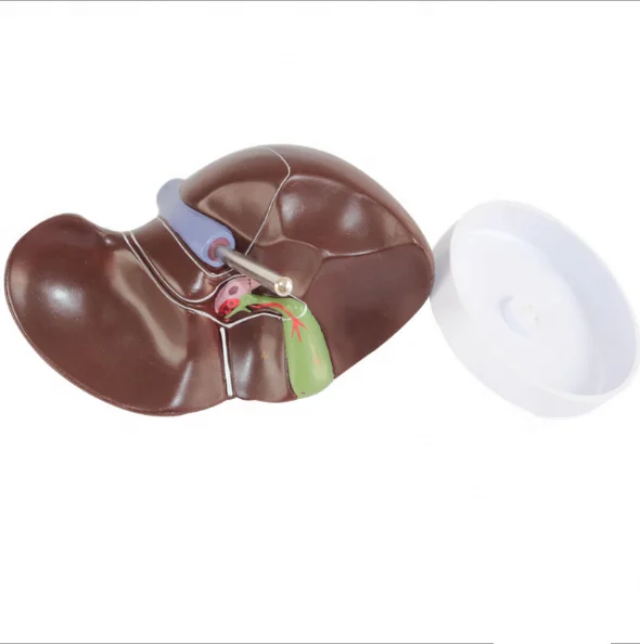 Medical Supplies Human Teaching Liver Pathological Model for School Display Tool Lab Equipment
