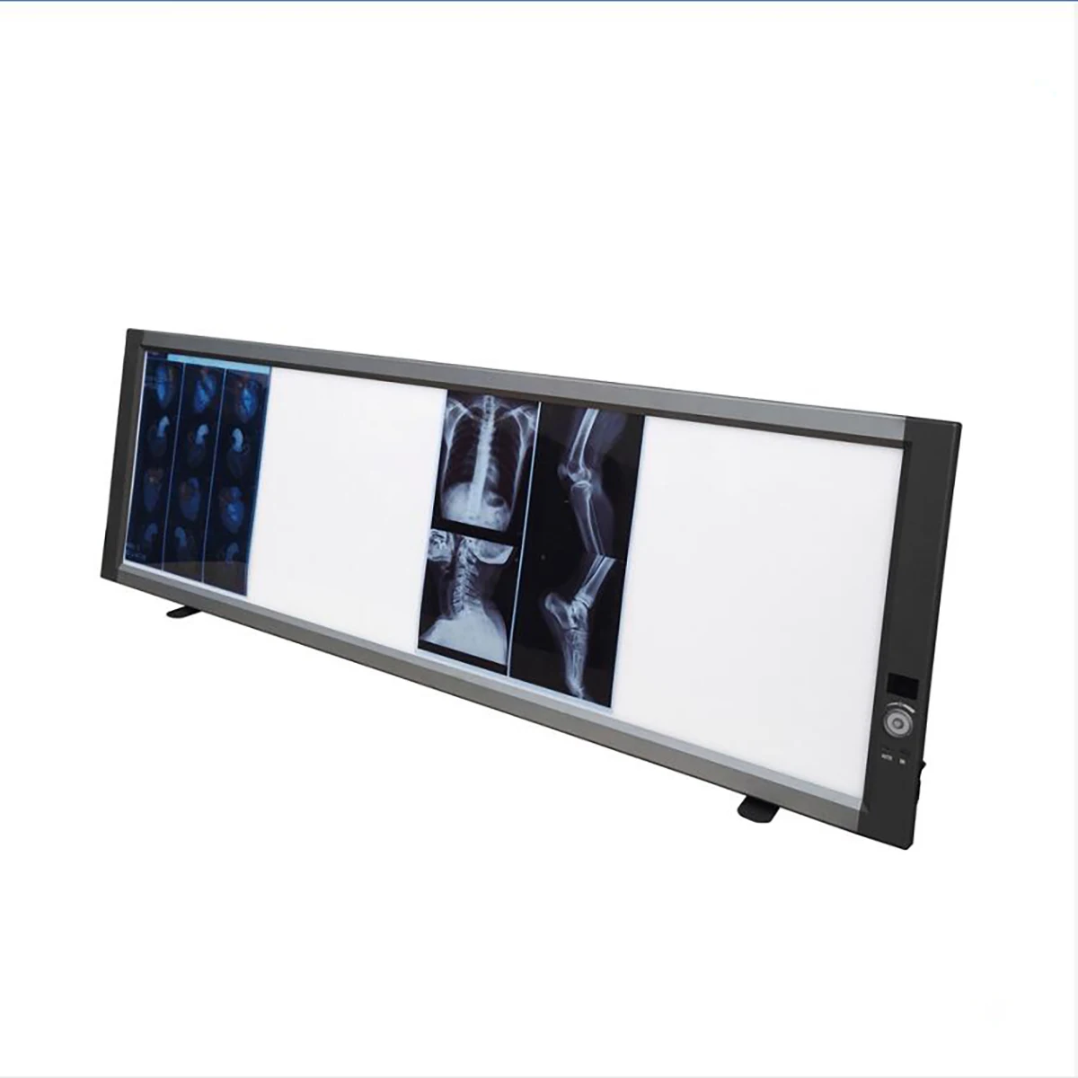 MSLZG4CAdjustable Medical LED X Ray Imaging Film Viewer Quadruple View Box X Ray Film Viewer