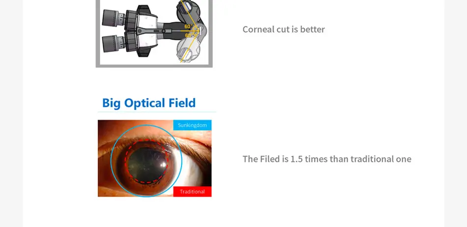 Ophthalmic 16mp Image Handheld Digital Portable Slit Lamp Handheld Slit Lamp Microscope