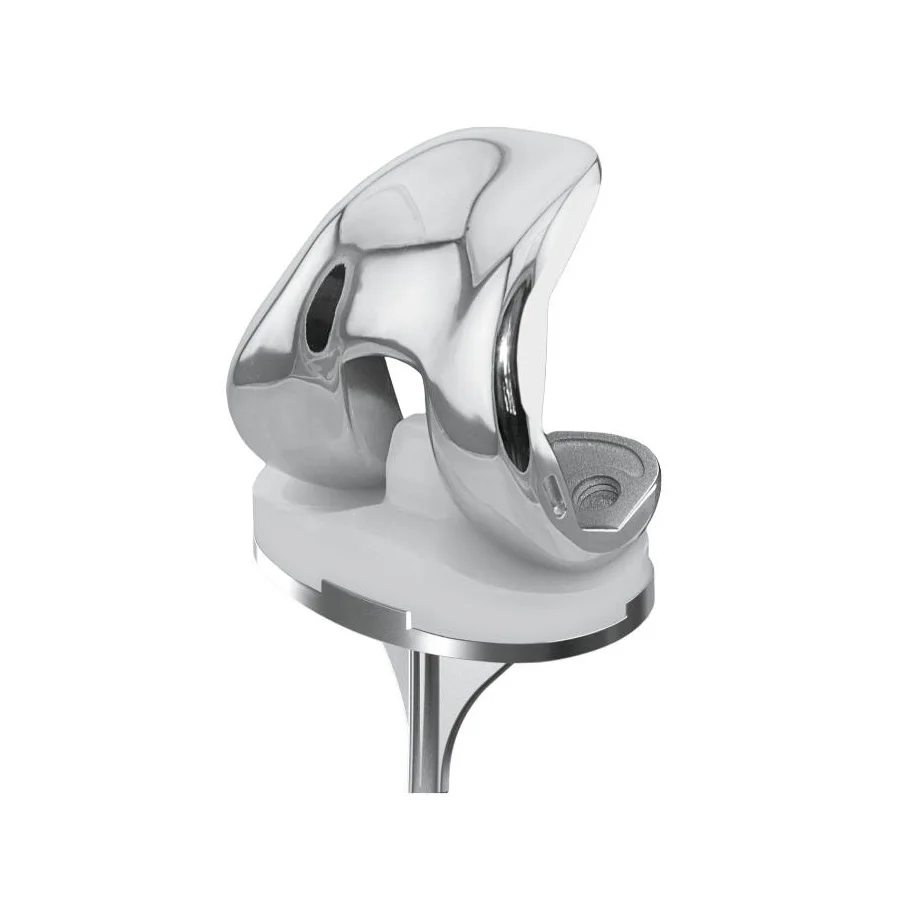Knee Prosthesis 1