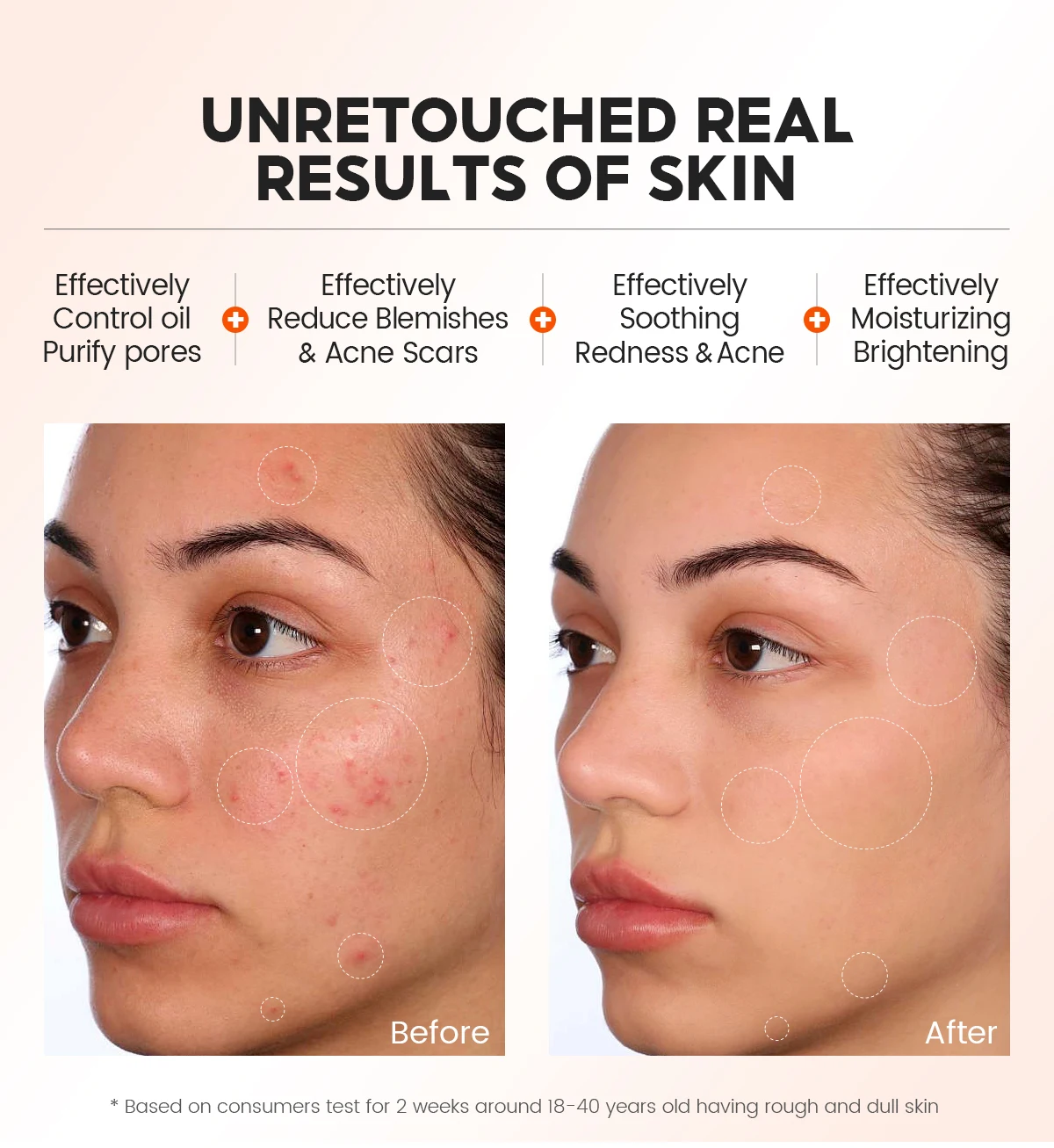 Vibrant Glamour 1% Salicylic Acid Skin Care Serum Anti-Acne Oil Control Exfoliating Toner for Adults