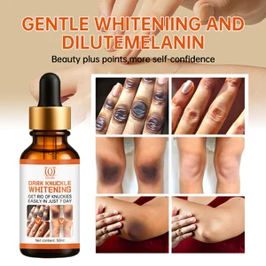 Calantha Dark Knuckles Fast Whitening Moisturizing Serum Pigmentation Correctors for Black Skin Hands Elbows Knees Intense