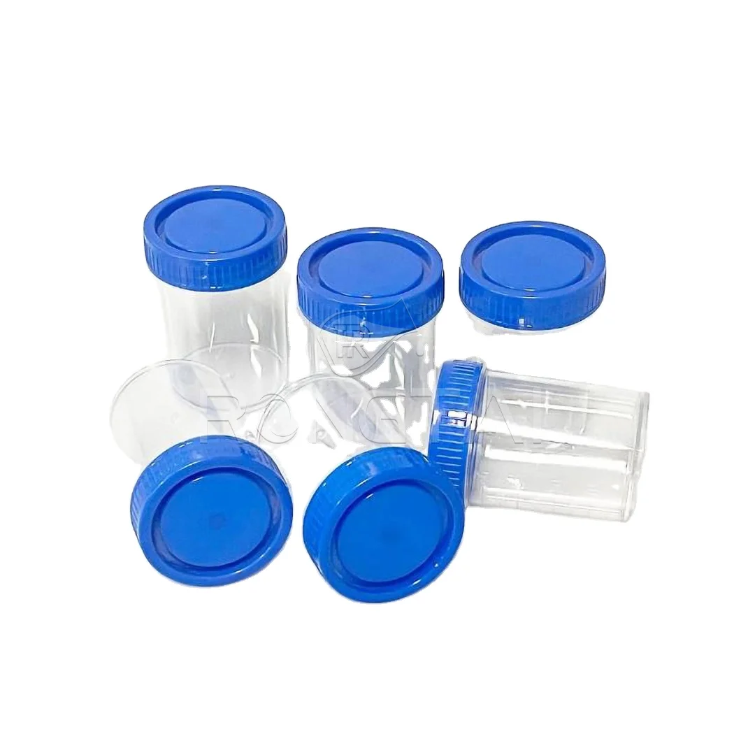 RONGTAI Plastic Specimen Container Distributors Urine and Stool Container China Urine Specimen Container White Lid