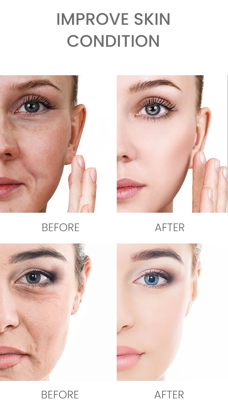 ESTELIN Skin Firming Moisturizing Anti Wrinkle Retinol Facial Serum 30ml