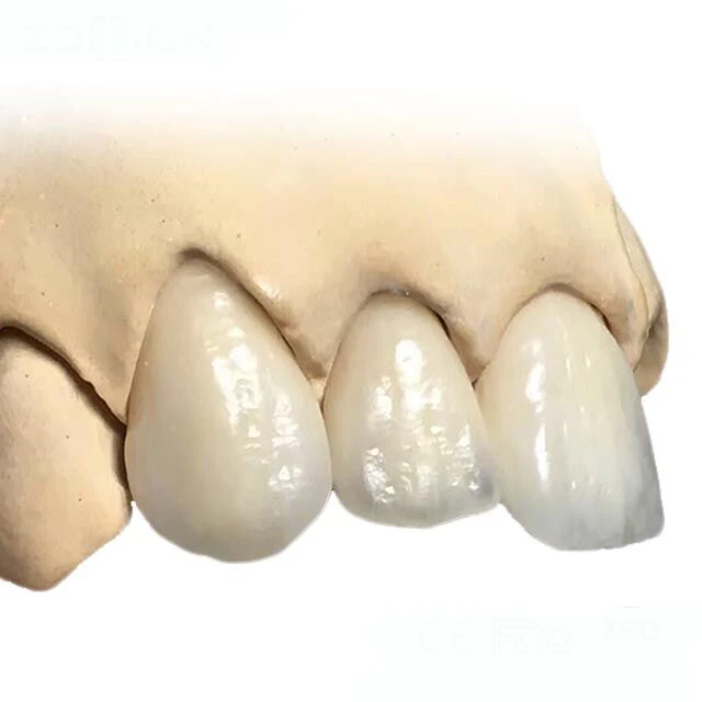 
 Циркониевый блок Cad Cam для зубной клипсы и короны  