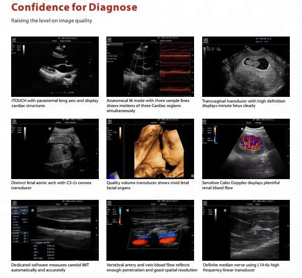 Mindray M7 M9 Portable Ultrasound Machine Color Doppler CW Cardiac Stress Echo Vascular 4D Original Mindray USG Price