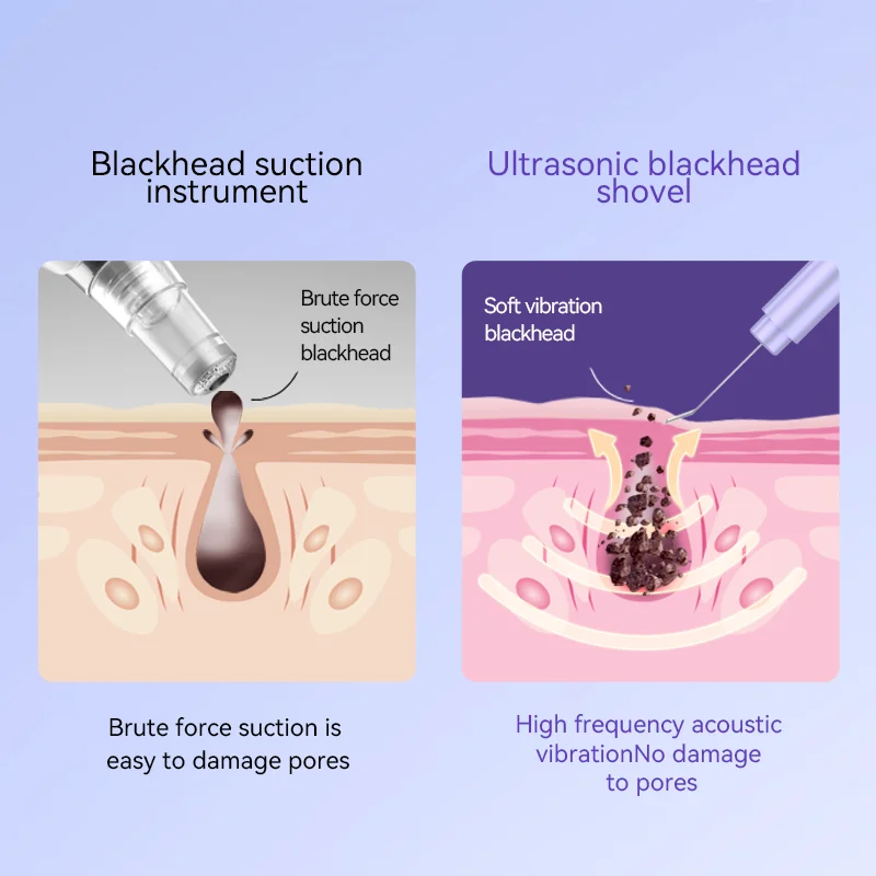 Высокочастотный скребок для лица, многофункциональный инструмент для ухода за кожей, скребок для кожи лица