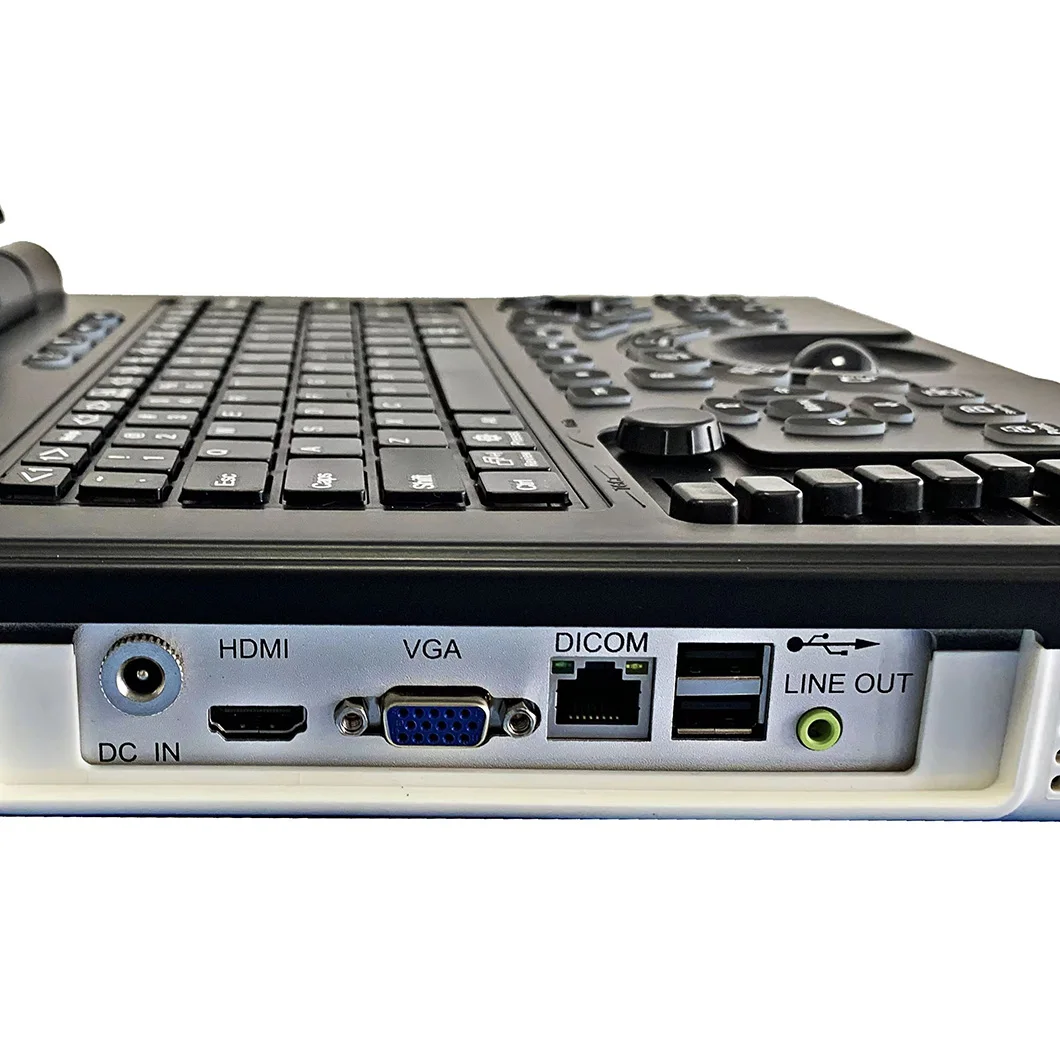 HUC-180 Full Digital 3d Laptop Color Doppler Ultrasound Diagnostic System Portable Ultrasonography Machine With Printer