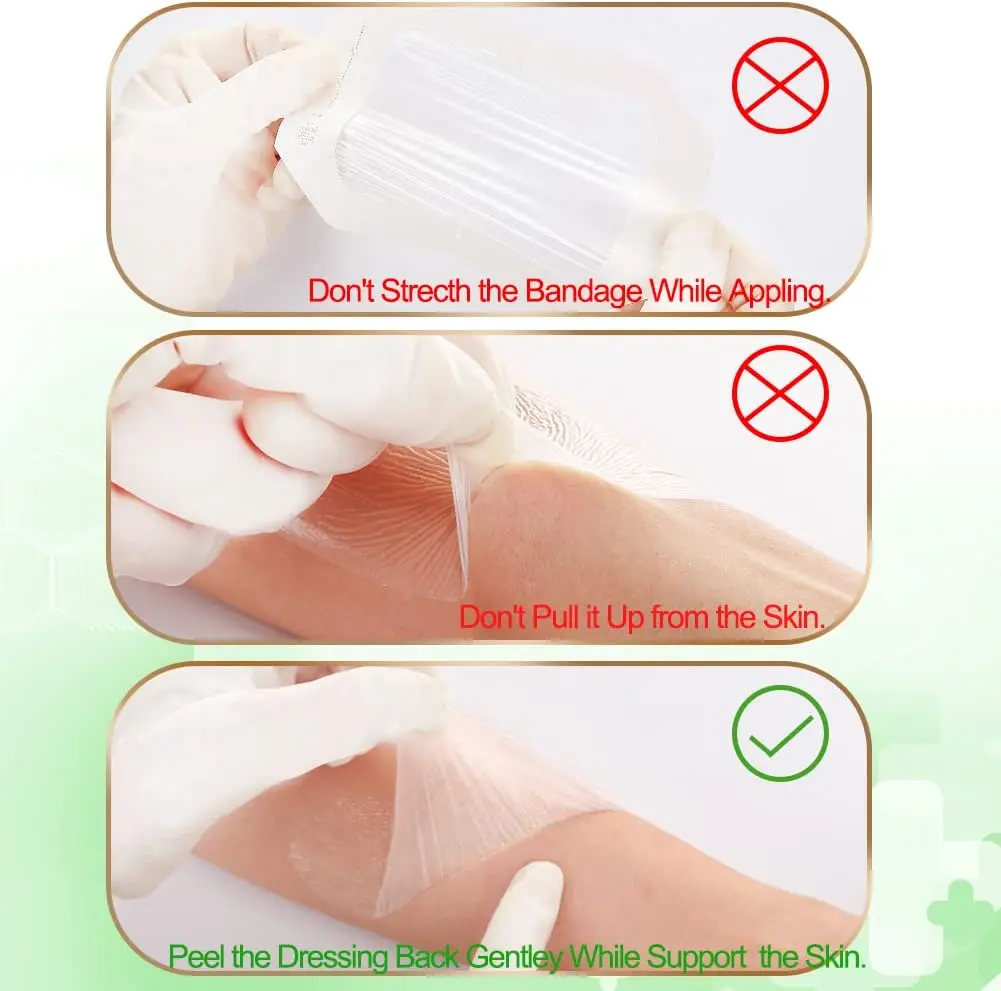 Transparent Film Dressing 2 3/8'' X 2 3/4'',100 Pack,Waterproof Wound