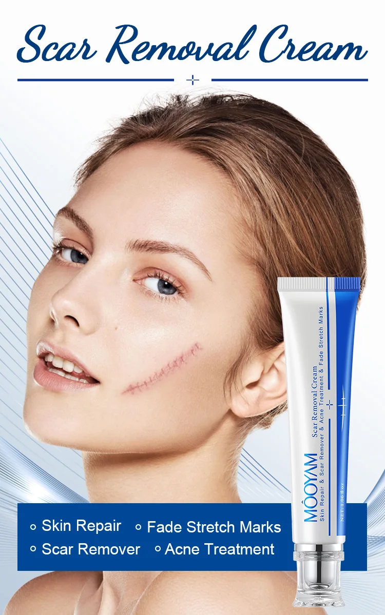 Fastest Acne Scar Removal Cream Face Care Scar Gel Bruise Repair Cream 