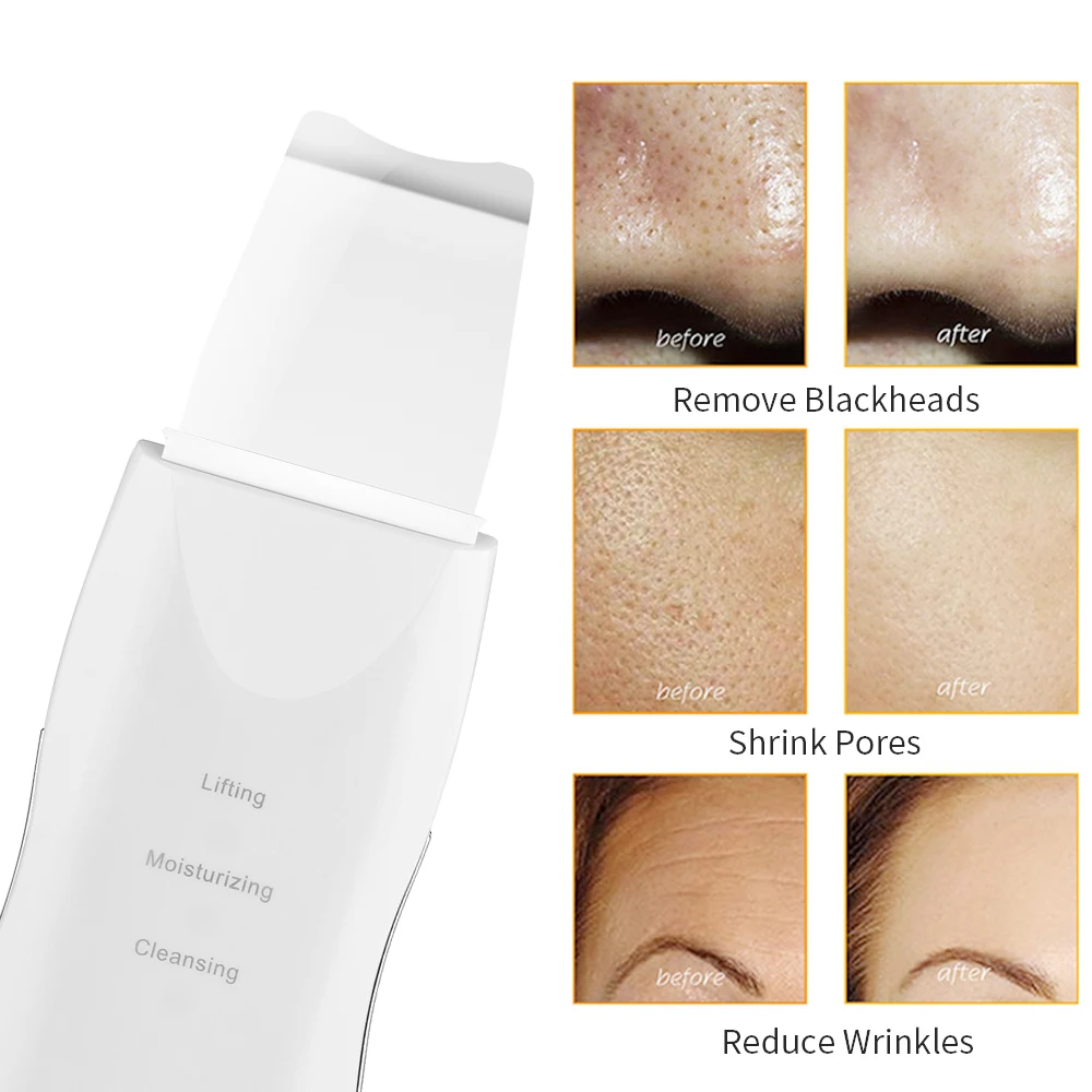 New Style  Cheap Personal Care White Black Ultrasonic Ion Professional Skin Scrubber.jpg