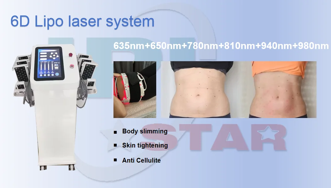 Newest mitsubishi Low level 210mw laser therapy 6 waves vertical 635 650nm infrared red light 6D lipolaser weight loss device