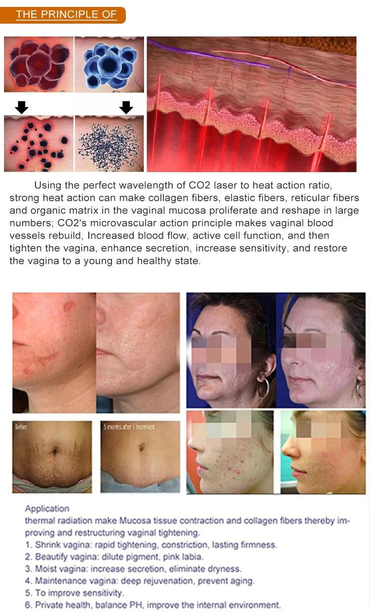 Запечатанное лазерное устройство, имитируемое с помощью лазерной машины с постоянным током CO2 - расстояние 0,1-2,6 мм 5