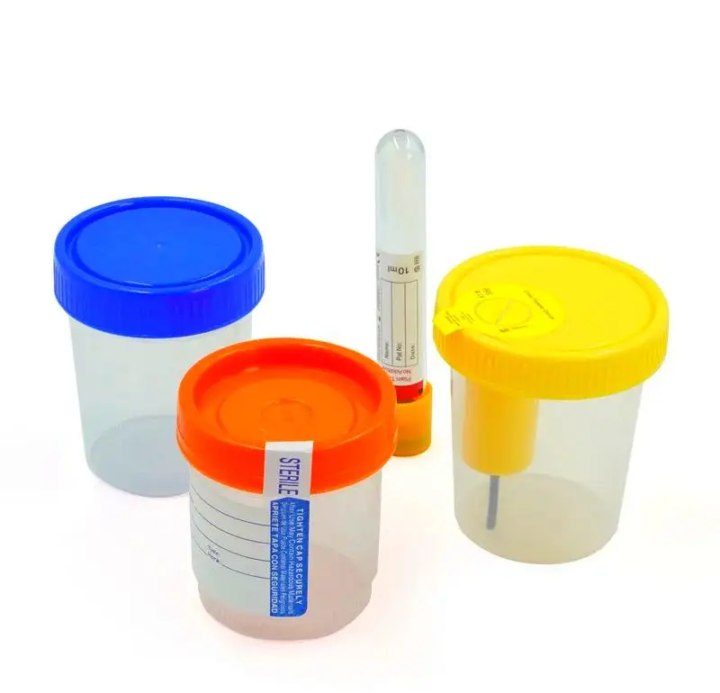 Sterile PP Vacuum Urine Sample Collection Cup Customizable OEM Medical Urine Specimen Container for Hospital & Laboratory Use