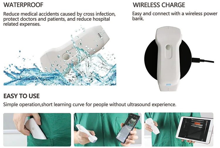 YUVNICE Veterinary Ultrasound Scanner Android Portable Ultrasound Machine Viatom 128 Elements Wireless Ultrasound Probe 3 in 1