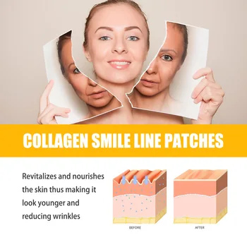 JAYSUING Collagen Smile Line Patches - Anti Wrinkle Face Patch