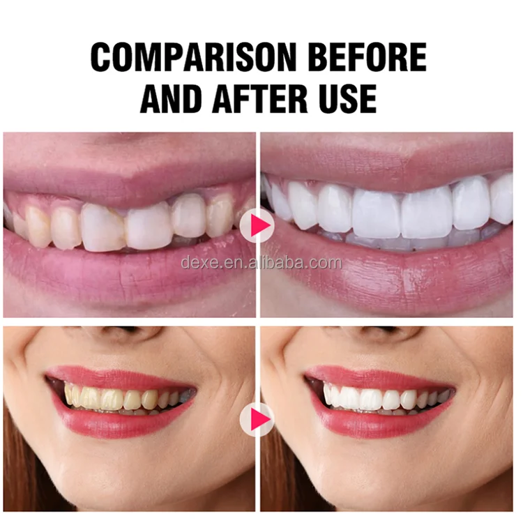 Toothpaste - Buy Toothpaste,Toothpaste,Toothpaste Product on Alibaba.com