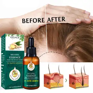 OEM ODM Hair Treatment Ginger Hair Growth Essential Oil Serum Anti Lost Beauty Products Fast Grow Repair Scalp Hair Growth Spray