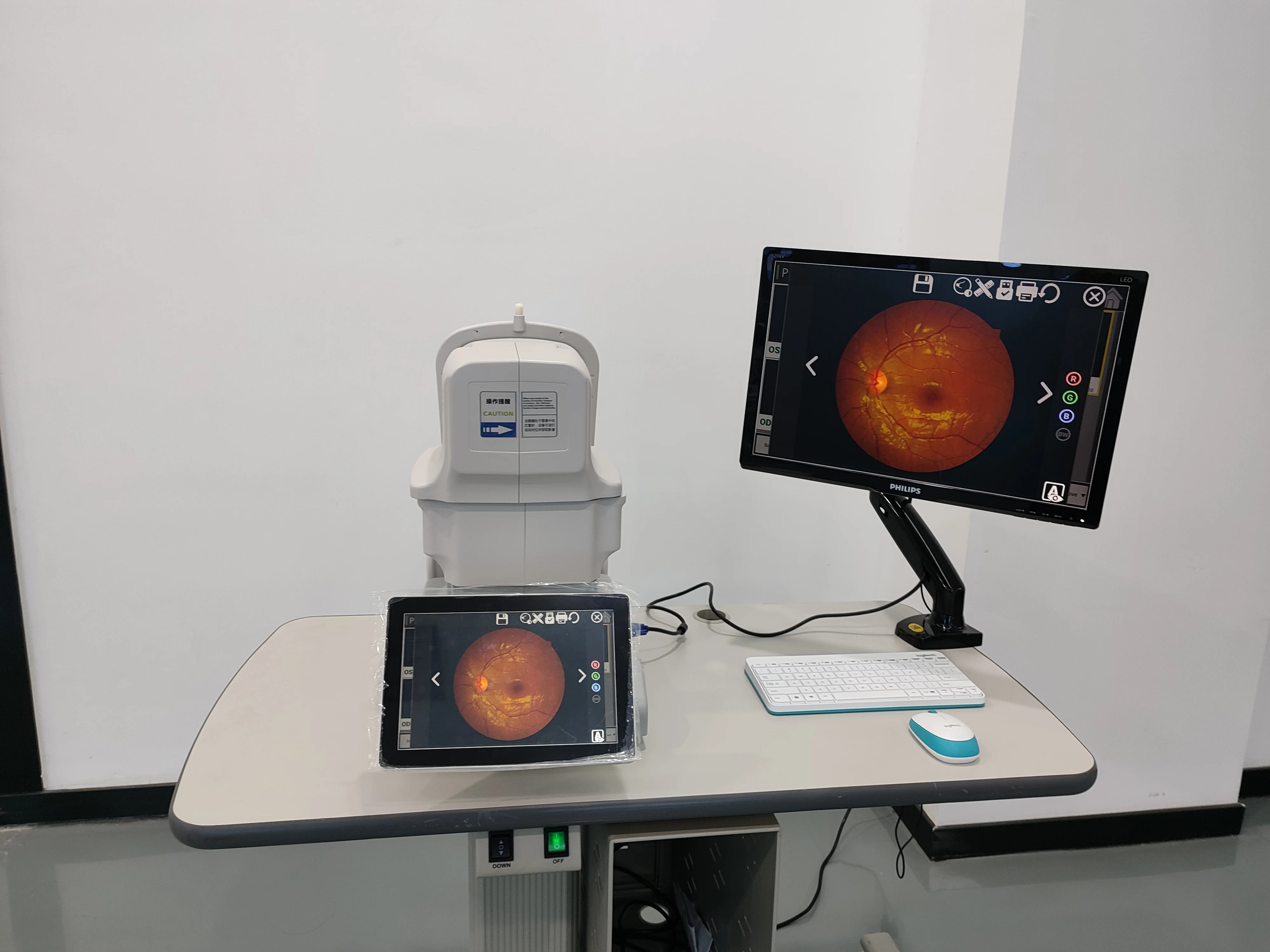 Automatic Chinrest Adjusting Cheapest and Fastest Kestrel 3100M Non-mydriatic Automatic Fundus Camera