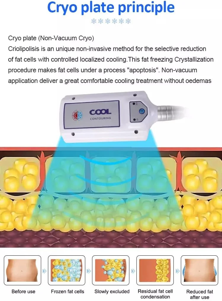 Cryolipolysis Machine with 8 Cryo Paddles for Fat Reduction & Body Sculpting 4 Discover the professional Cryolipolysis Machine with 8 Cryo Paddles for non-invasive fat freezing, body contouring, slimming, and salon body sculpting treatments. Designed for aesthetic clinics, med spas, and beauty salons seeking advanced multi-handle cryotherapy technology. Cryolipolysis Machine with 8 Cryo Paddles for Fat Reduction & Body Sculpting