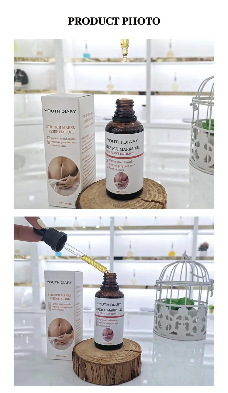 Tiktok Hot Selling Youth Dairy Stretch Marks Remover Essential Oils