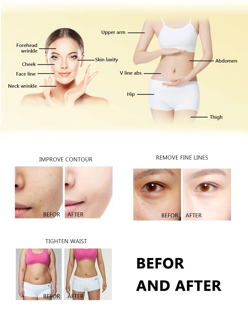 Gold TT Hifu 3 In 1 Hifu 360 Rotation 9D 12D Face Tightening Wrinkle Removal Machine Professional Hifu