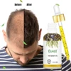 lavender hair growth serum