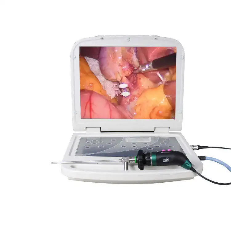 HD portable endoscope medical endoscope camera system video processing system endoscope camera module   for ENT