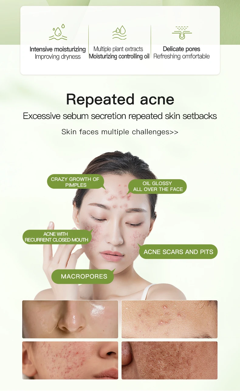 Wholesale Icesea Natural Australian Tea Tree Herbal Sheet Face Moisturizer Pimple Reduction Pore Cleansing Private Label Service(pic1)