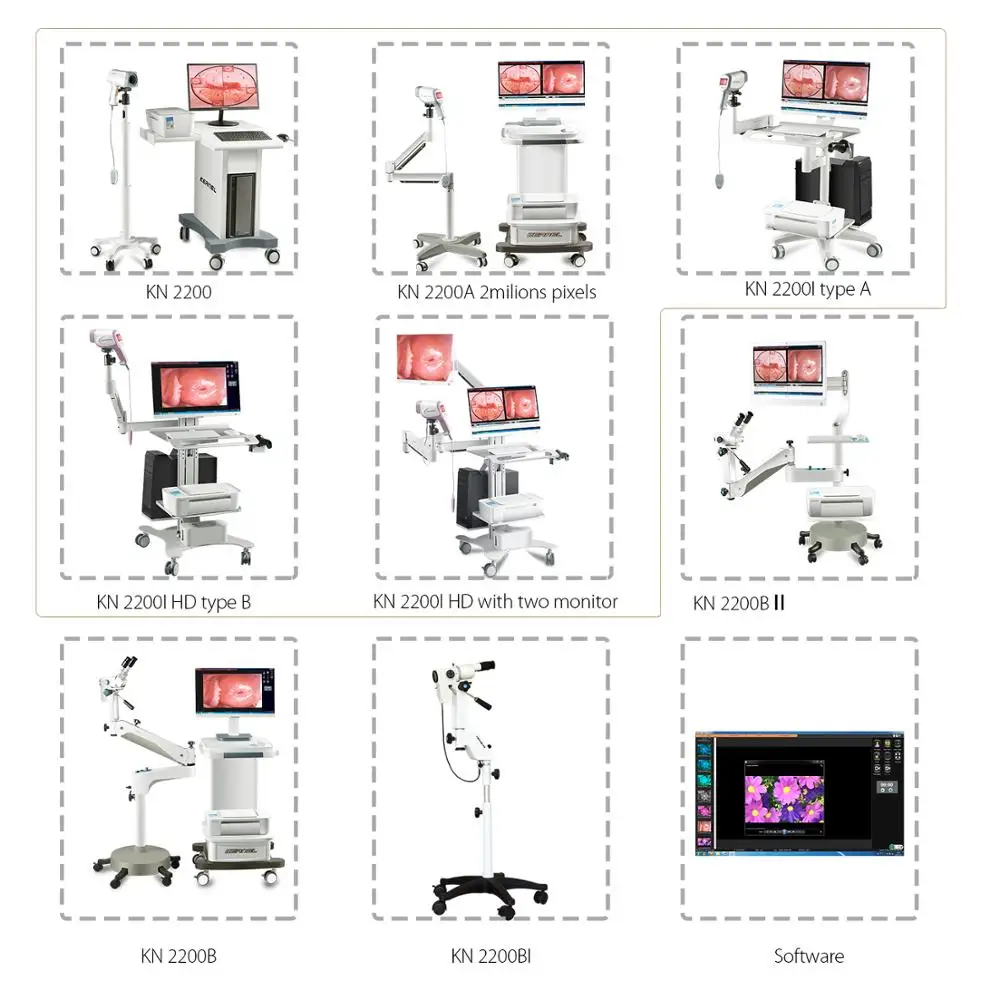 Kernel Colposcopy Examination Surgical Instruments Full hd Camera Colposcope Price Equipment for  Gynecology with Software