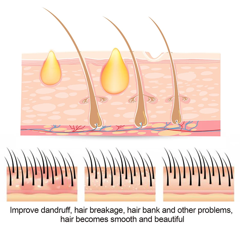 new arrival anti dandruff itchy restore damage hair repair scalp care treatment sulfur massage shampoo