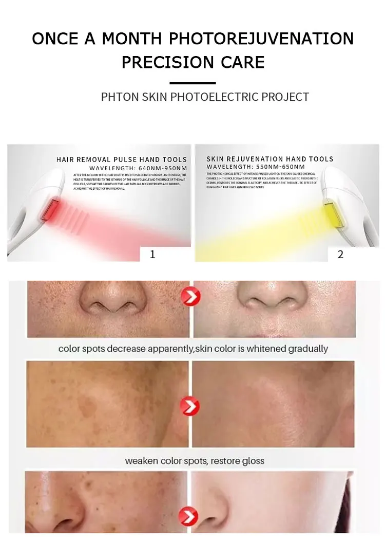 Professional DPL & IPL Photon E-Light Beauty Device NdYag Laser for Skin Rejuvenation & Hair Removal