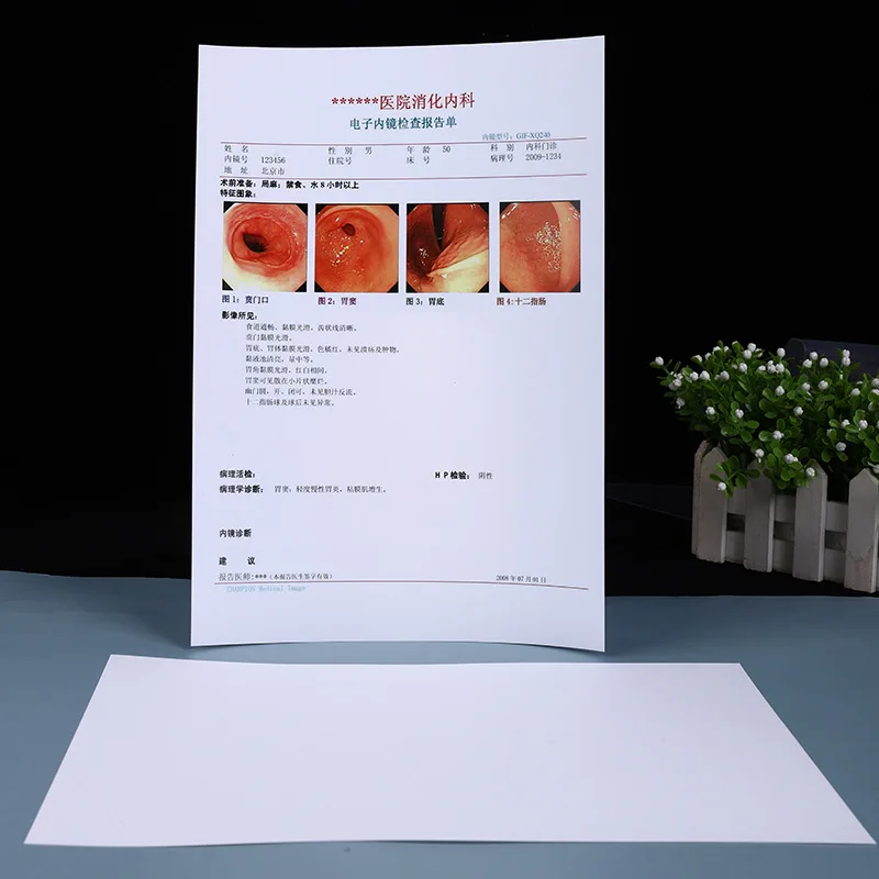 Inkjet Blue Medical Dry Film Transparent Blue Xray Film For CT DR MRI Radiological Device