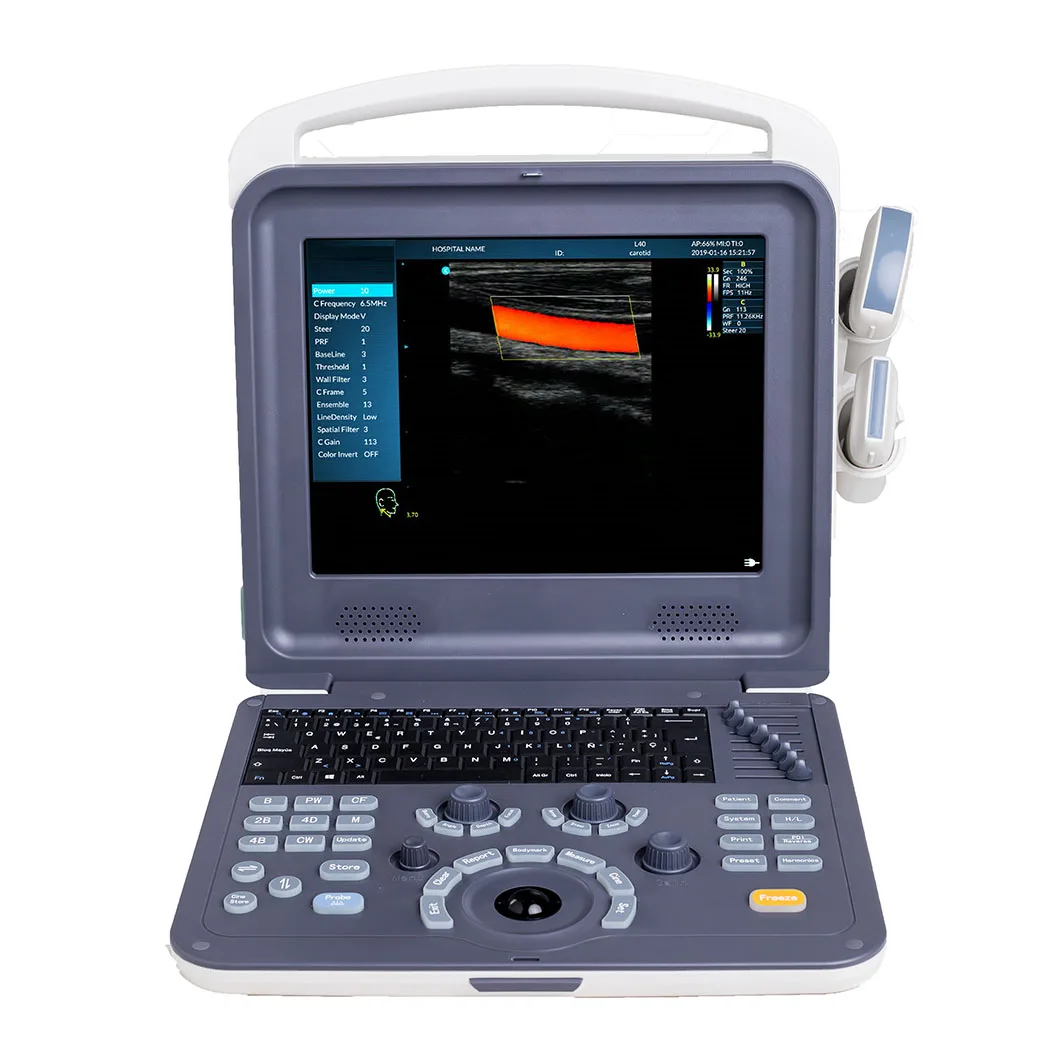 HUC-260 Hand-carried Fibroscan Machine Portable Color Dopler Diagnostic Ultrasound Scanner