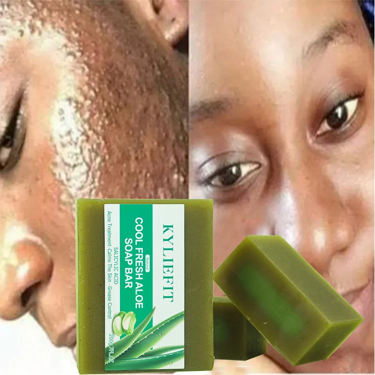 Salicylsure Khlende Aloe-Seife Porenreinigung Peeling Aknebekmpfung  Hautpflege-Seife zur Hautglttung und gegen Unreinheiten